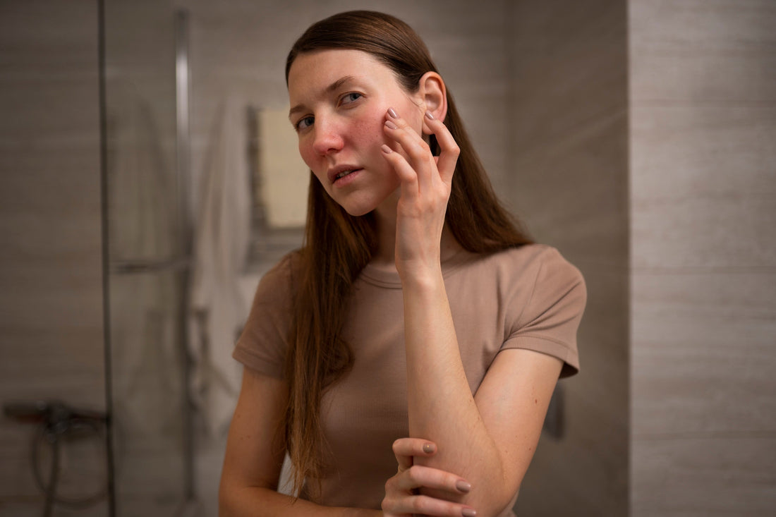 Atopic Dermatitis on the Face: Understanding, Treating, and Relieving with Natural Solutions