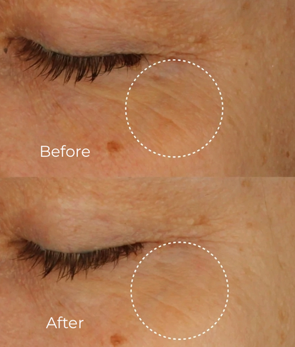 Élixir Bio-Rétinol Contour des Yeux